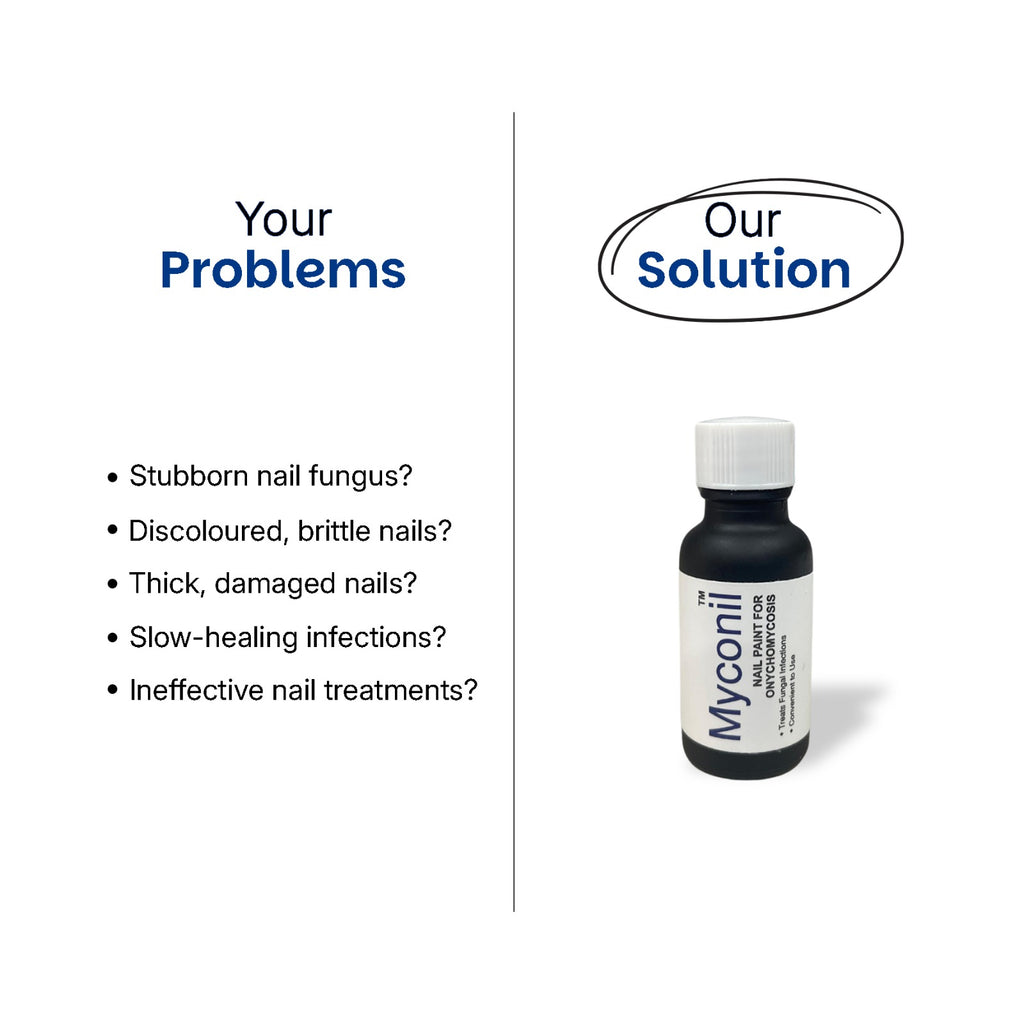 Myconil Anti Fungal Nail Paint by Rederm