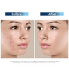 Clariderm Serum