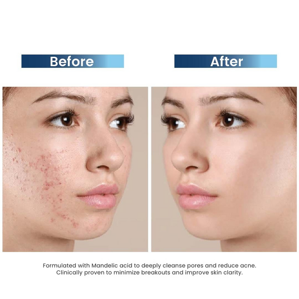 Clariderm Serum
