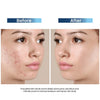 Clariderm Serum