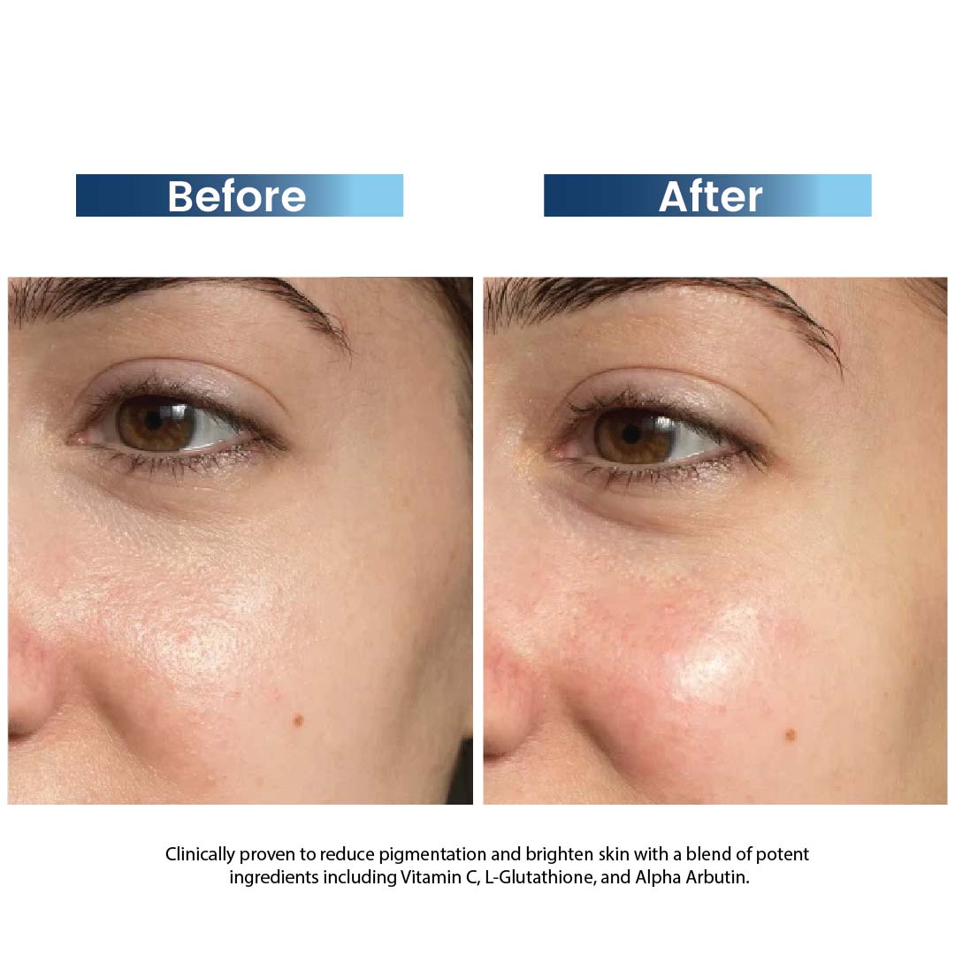 Skin Brightening & Depigmentation Regime