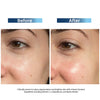 Wynn Serum